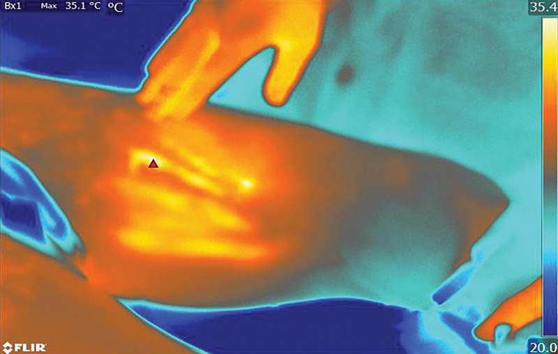 technology-page-image_thermal-image-800w